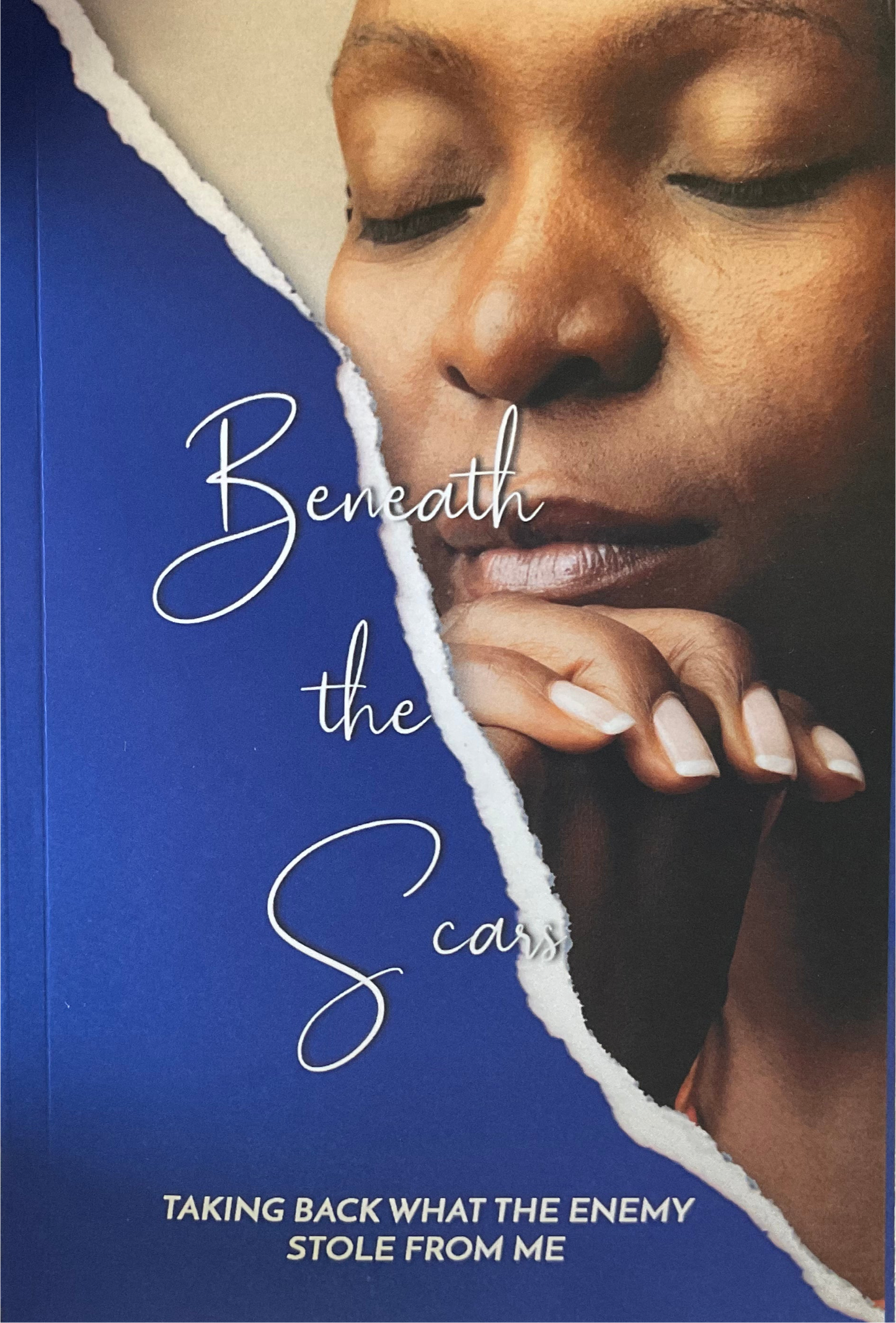 Book: Beneath the Scars